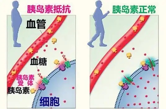 人体内胰岛素有什么作用？