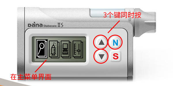 丹纳胰岛素泵医生模式详解