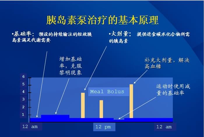 丹纳胰岛素泵工作原理