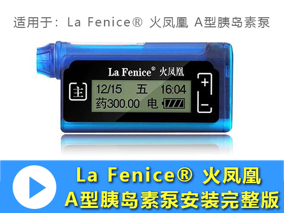 La Fenice® 火凤凰 A型胰岛素泵安装完整版