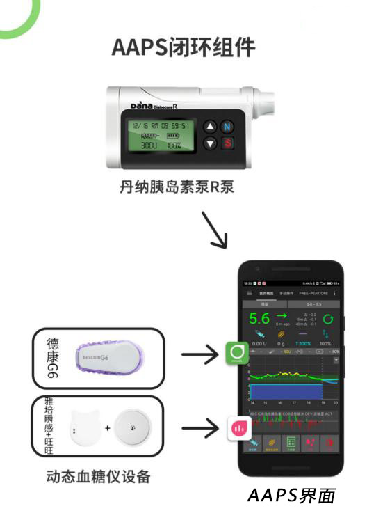 闭环胰岛素泵